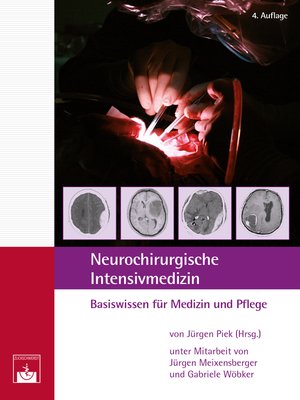 cover image of Neurochirurgische ﻿Intensivmedizin